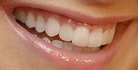 Picture of Ashley Tisdale teeth and smile