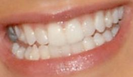 Picture of Ashley Tisdale teeth and smile