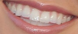 Picture of Audrina Patridge teeth and smile