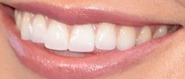 Picture of Audrina Patridge teeth and smile