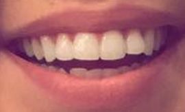 Picture of Auli'i Cravalho teeth and smile
