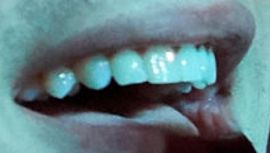 Picture of Austin Mahone teeth and smile