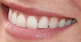 Picture of Bar Refaeli teeth and smile