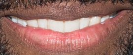 Picture of Baratunde Thurston teeth and smile