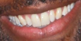 Picture of Baratunde Thurston teeth and smile