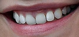 Picture of Barbara Palvin teeth and smile