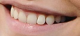 Picture of Barbara Palvin teeth and smile