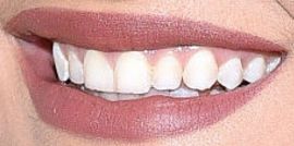 Picture of Bebe Rexha teeth and smile