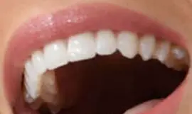 Picture of Becca Kufrin teeth and smile