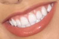 Becky G's teeth