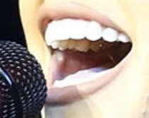 Becky G's teeth