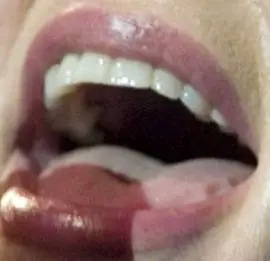 Picture of Belinda Carlisle teeth and smile