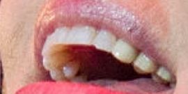 Picture of Belinda Carlisle teeth and smile