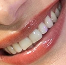 Picture of Bella Hadid teeth and smile
