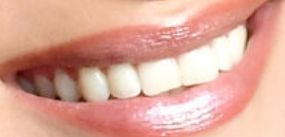 Picture of Bella Hadid teeth and smile