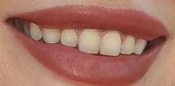 Picture of Bella Thorne's teeth and smile while smiling