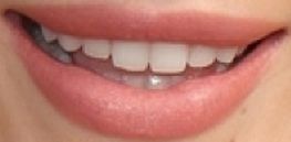 Picture of Bella Thorne's teeth and smile while smiling