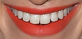 Picture of Beth Behrs teeth and smile