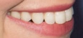 Picture of Beth Behrs teeth and smile