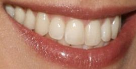 Picture of Beth Ostrosky Stern teeth and smile