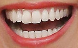 Picture of Beth Ostrosky Stern teeth and smile