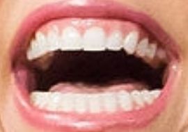 Picture of Bethenny Frankel teeth and smile