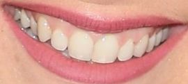 Picture of Billie Lourd teeth and smile
