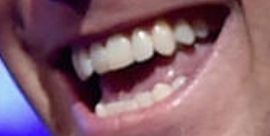 Picture of Billy Miller teeth and smile