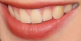 Picture of Bindi Irwin teeth and smile