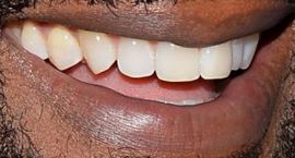 Picture of Blair Underwood teeth and smile