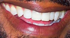 Picture of Blair Underwood teeth and smile
