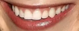 Blake Lively's teeth and smile