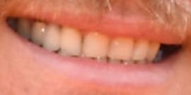 Picture of Blake Shelton teeth and smile