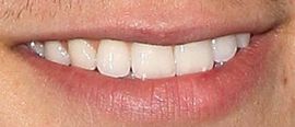 Picture of Booboo Stewart teeth and smile