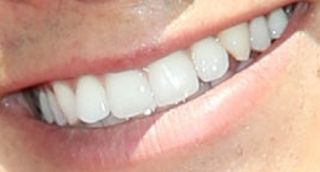 Picture of Booboo Stewart teeth and smile