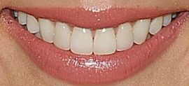 Picture of Brenda Song teeth and smile