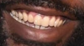 Picture of Brian Tyree Henry teeth and smile