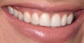 Picture of Bridget Moynahan teeth and smile