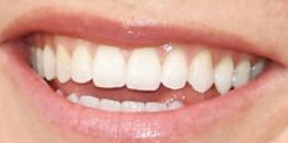 Brie Larson's teeth and smile