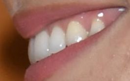 Brie Larson's teeth and smile
