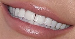 Britney Spears teeth
