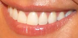 Picture of Brooke Burke teeth and smile