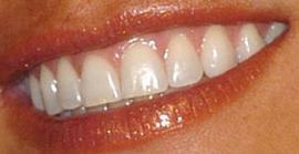 Picture of Brooke Burke teeth and smile