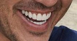 Picture of Brooks Koepka teeth and smile