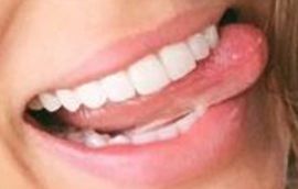 Picture of Brooks Nader teeth and smile