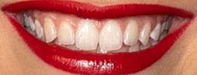 Picture of Brynn Cartelli teeth and smile