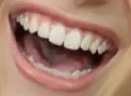 Picture of Brynn Cartelli teeth and smile