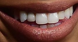 Picture of Brytni Sarpy teeth and smile