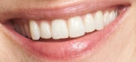Picture of Caitriona Balfe teeth and smile