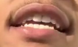 Picture of Cam Anthony teeth and smile